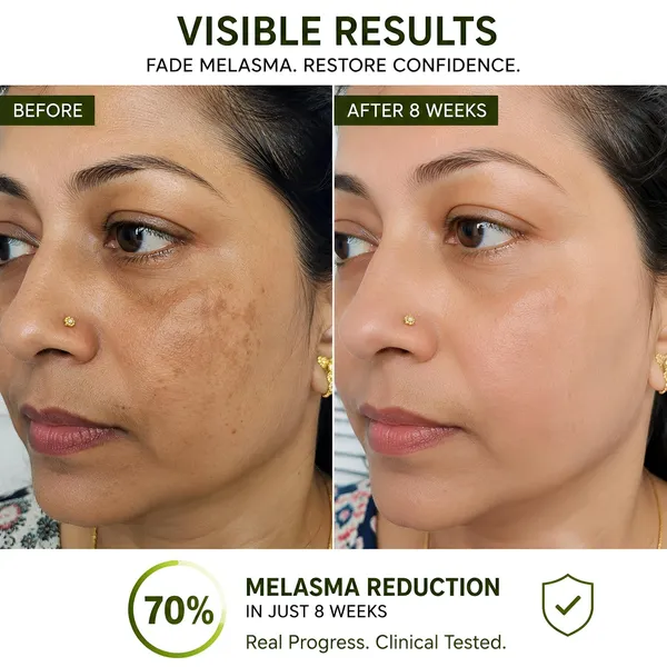 Dark_Spot_Corrector_Face_Serum