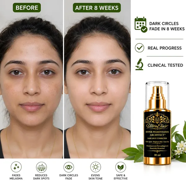 Dark_Spot_Corrector_Face_Serum