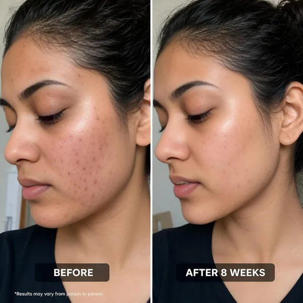 Salicylic_Acid_Niacinamide_Glycolic_Acid_Serum