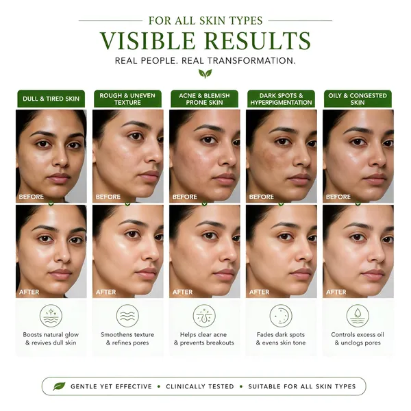 Glycolic_Acid_Exfoliating_Facial_Toner