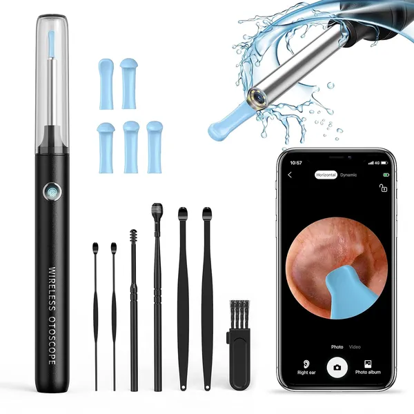 Ear_Wax_Removal_Camera_With_Otoscope
