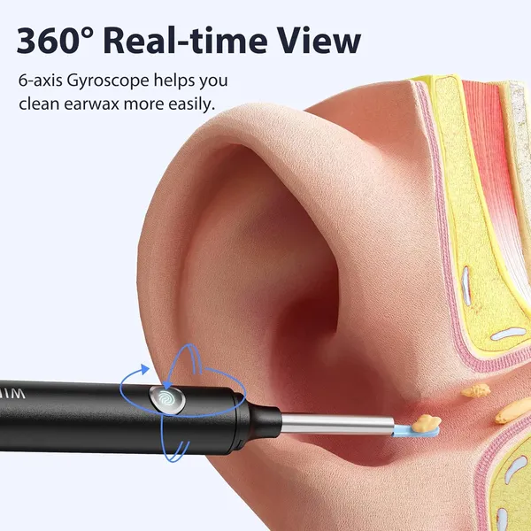 Ear_Wax_Removal_Camera_With_Otoscope