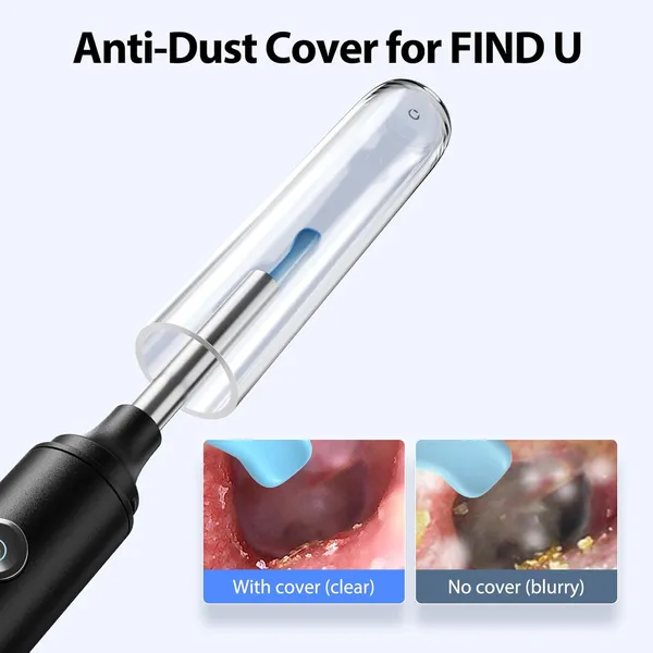Ear_Wax_Removal_Camera_With_Otoscope