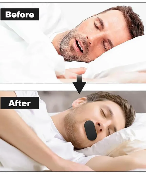 Mouth_Tape_Strips_For_Sleeping