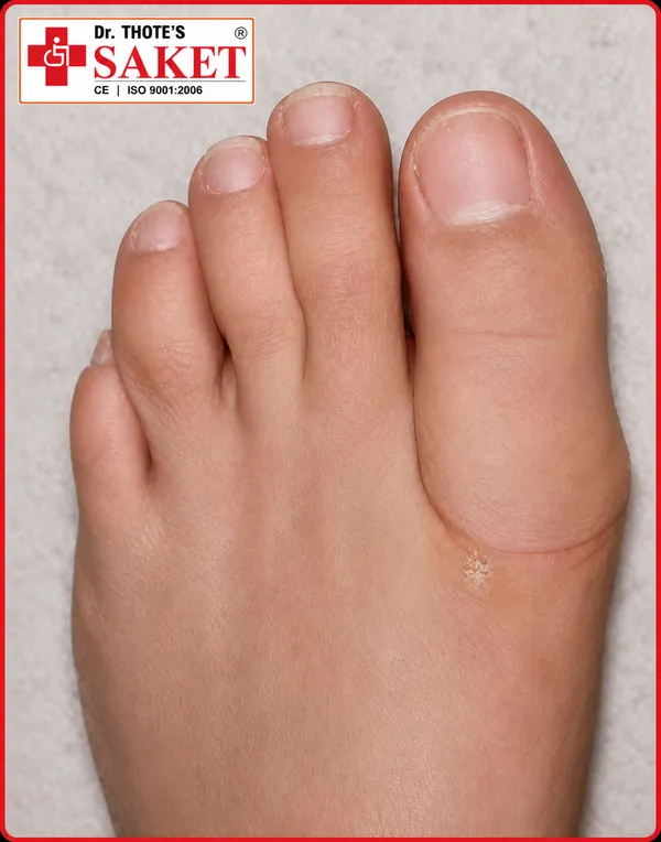 foam_like_ankle_stirrup