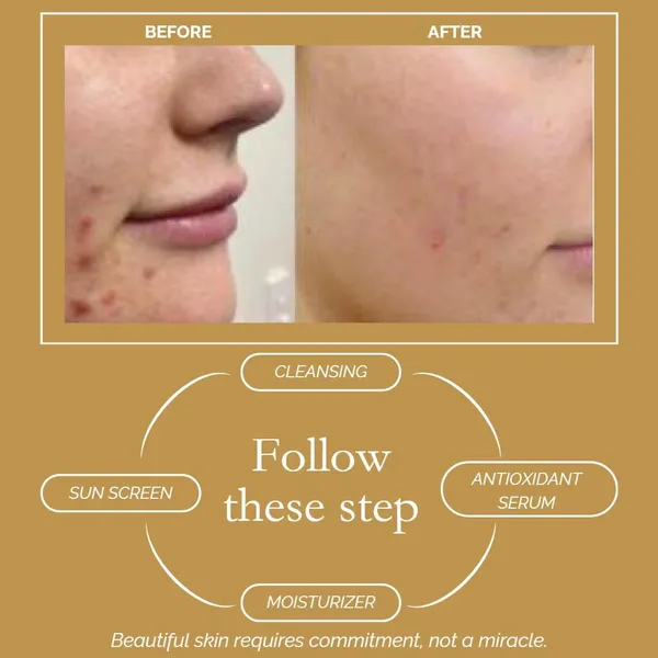 Kadife_|_Anti-Oxidant_Serum,_30ml,_Brightening_&_Glowing_Skin_Complexion,_with_Alpha_Arbutin,_Allantoin_&_Acerola_Extract_For_all_Skin_Type