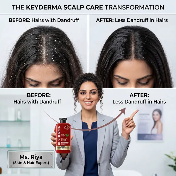 Scalpcare_Zinc_Pyrithione_Climbazole_Anti-Dandruff_Shampoo