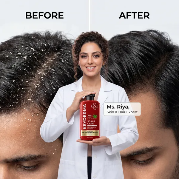 Scalpfix_Redensyl_Biotin_Hair_Fall_Control_Conditioner
