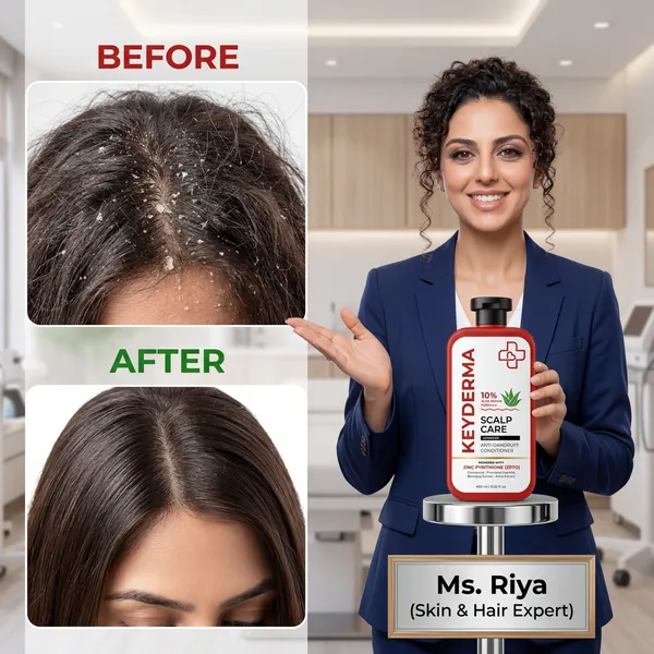 Scalpcare_Zinc_Pyrithione_Anti-Dandruff_Hair_Conditioner