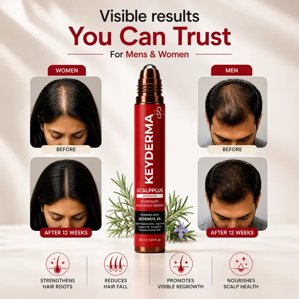 Rosemary_Redensyl_Procapil_Hair_Growth_Serum