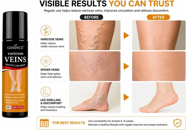 Gosince_Advanced_Varicose_Veins_Treatment_Spray_|_Supports_Healthy_Circulation_&_Soothes_Spray_(2_x_15_ml)