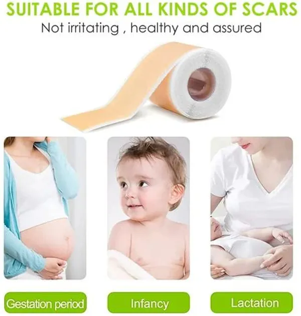 Gosince_Medical-Grade_Silicone_Scar_Tape_Roll_–Reusable,Cut-to-Size_Scar_Reduction_Sheet_Crepe_Bandage_(4_cm)