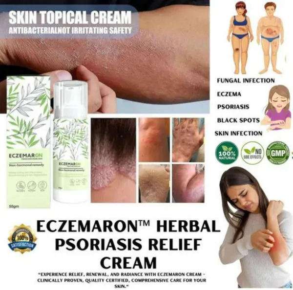 Gosince_Eczemaron_Psoriasis_&_Eczema_Relief_Spray_|_Steroid_Free_|_Fast_Soothing_Skin_Repair_(50_g)