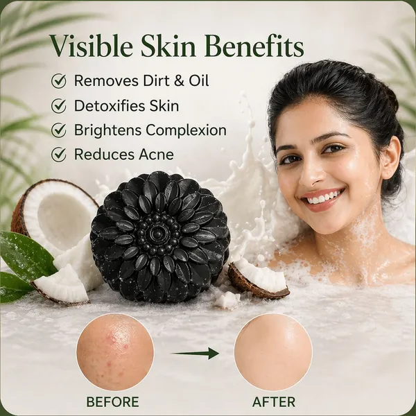 Gosince_Charcoal_Soap_for_Acne_Care_(3_x_34_g)