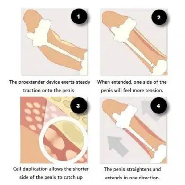 Steel_Silicone_Intimate_Wellness_Extender_Device