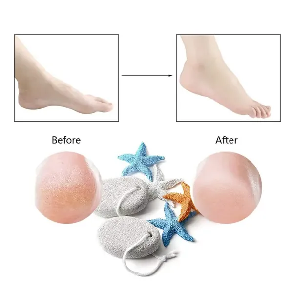 Pumice_Stone_Foot_File