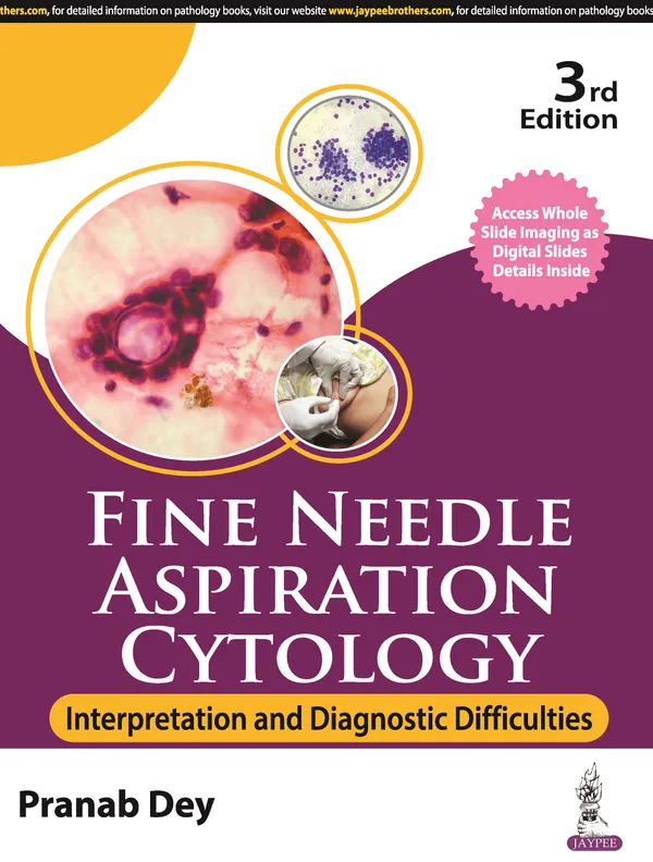 Fine_Needle_Aspiration_Cytology_Interpretation_And_Diagnostic_Difficulties