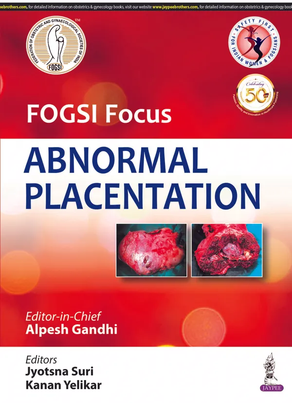Fogsi_Focus_Abnormal_Placentation