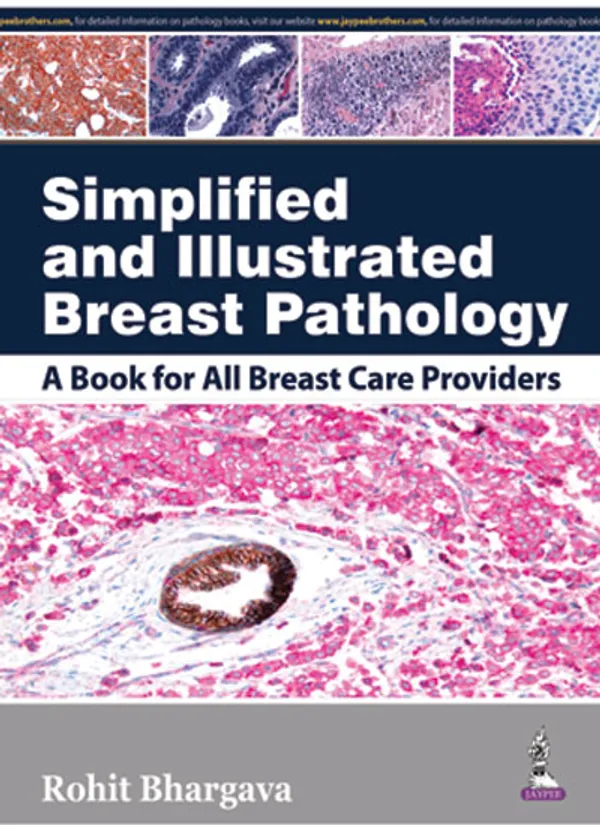 Simplified_And_Illustrated_Breast_Pathology_A_Book_For_All_Breast_Care_Providers