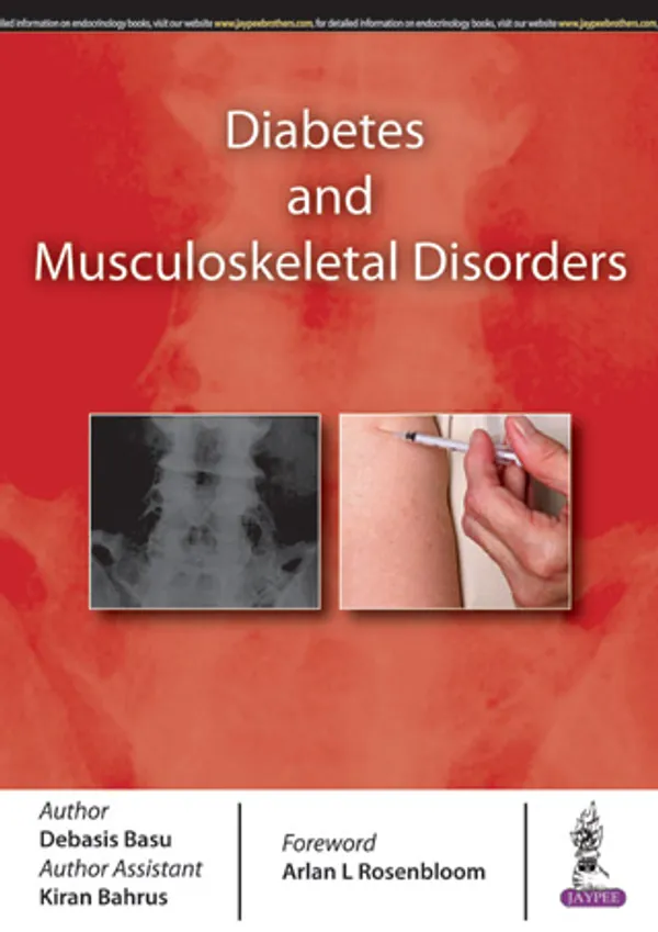 Diabetes_And_Musculoskeletal_Disorders