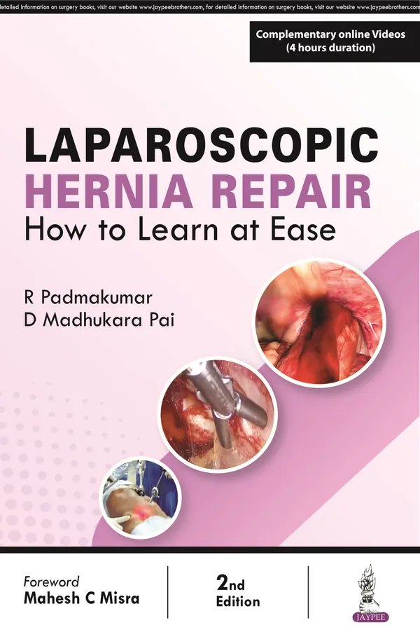 Laparoscopic_Hernia_Repair_How_To_Learn_At_Ease