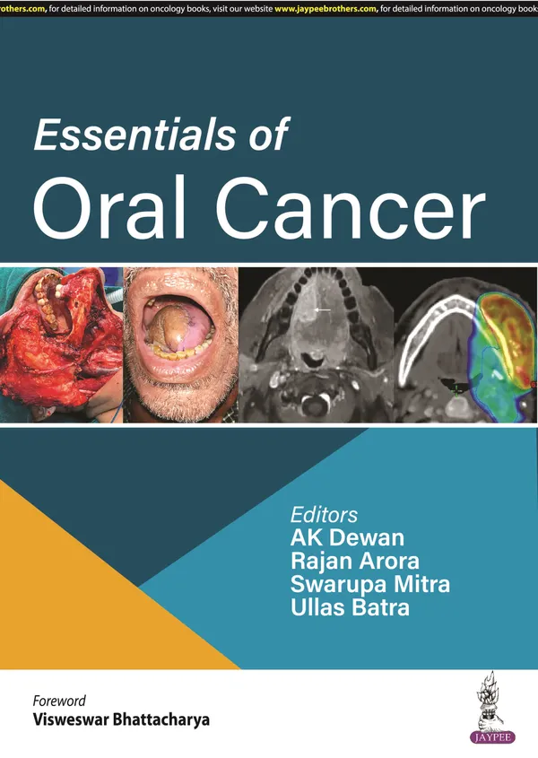 Essentials_Of_Oral_Cancer