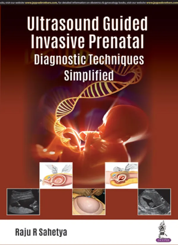 Ultrasound_Guided_Invasive_Prenatal_Diagnostic_Techniques_Simplified