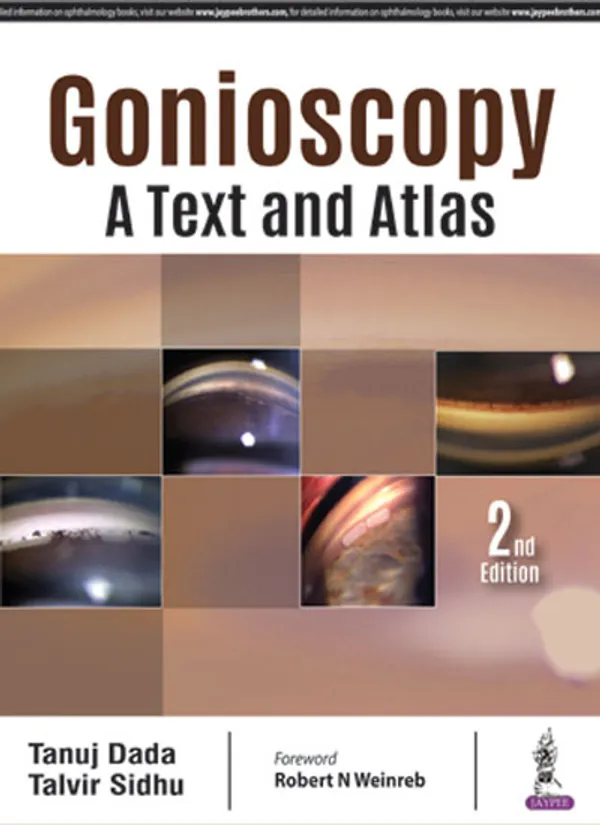 Gonioscopy_A_Text_And_Atlas