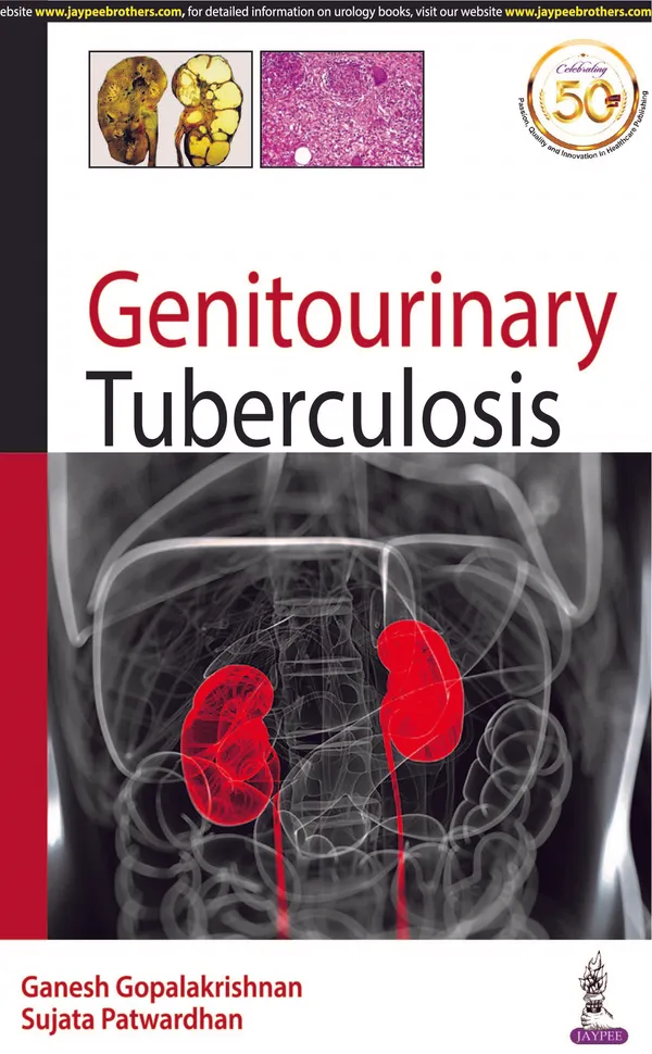 Genitourinary_Tuberculosis