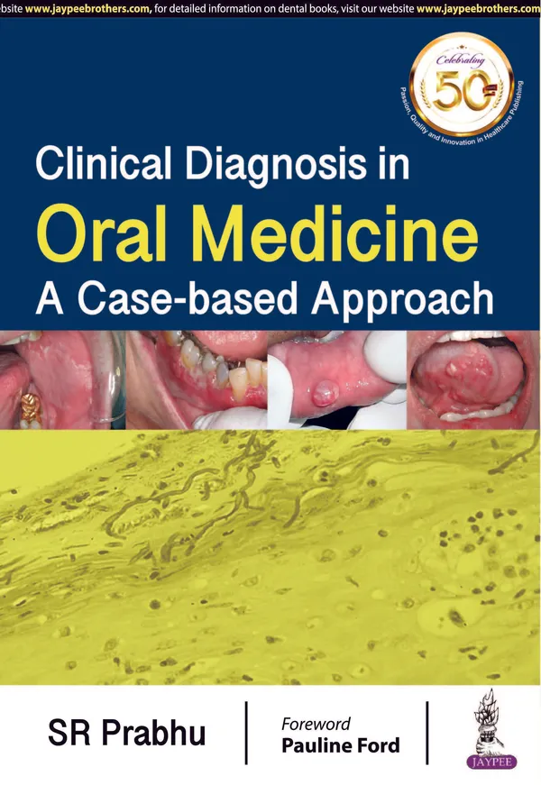 Clinical_Diagnosis_In_Oral_Medicine_A_Case_Based_Approach