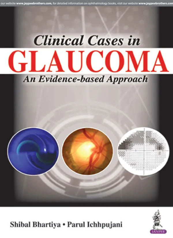 Clinical_Cases_In_Glaucoma_An_Evidence_Based_Approach
