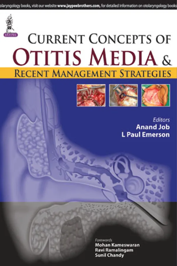 Current_Concepts_Of_Otitis_Media_And_Recent_Management_Strategies