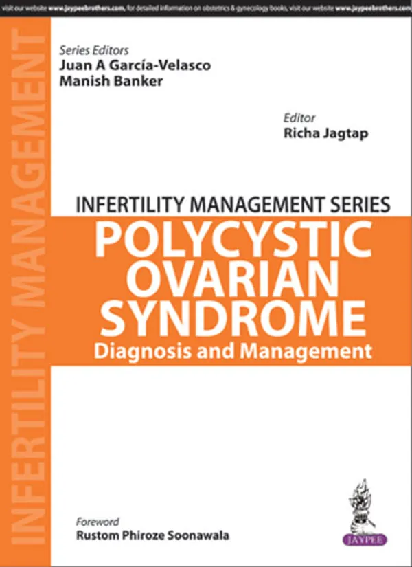 Polycystic_Ovarian_Syndrome_Diagnosis_And_Management