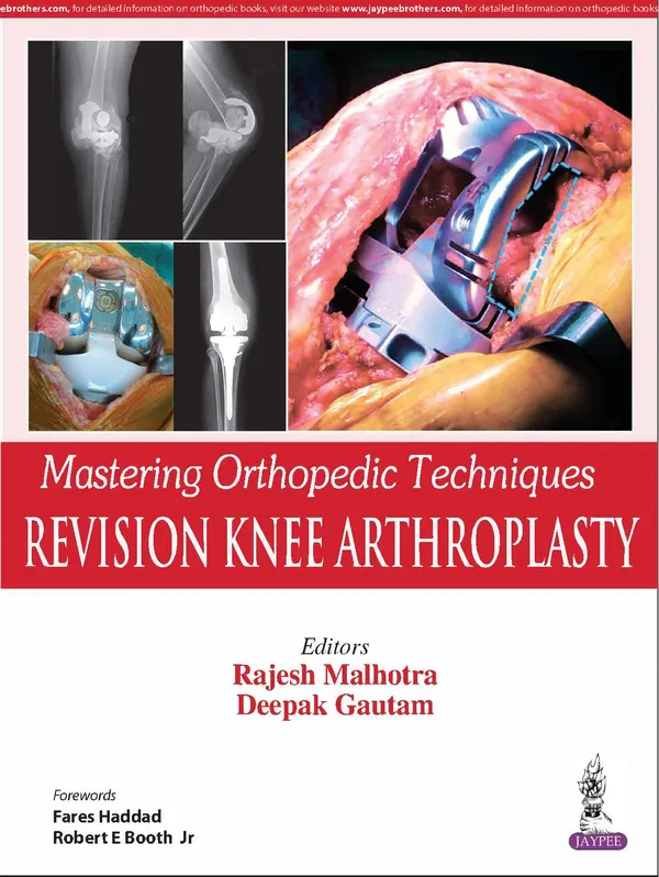 Mastering_Orthopedic_Techniques_Revision_Knee_Arthroplasty