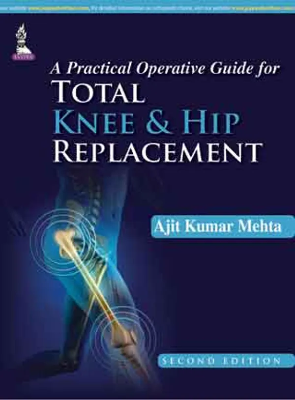 A_Practical_Operative_Guide_For_Total_Knee_And_Hip_Replacement