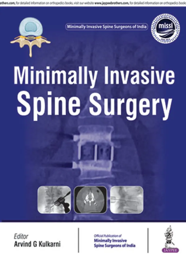 Minimally_Invasive_Spine_Surgery