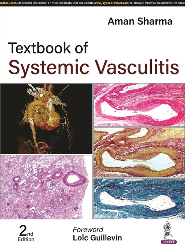 Textbook_Of_Systemic_Vasculitis