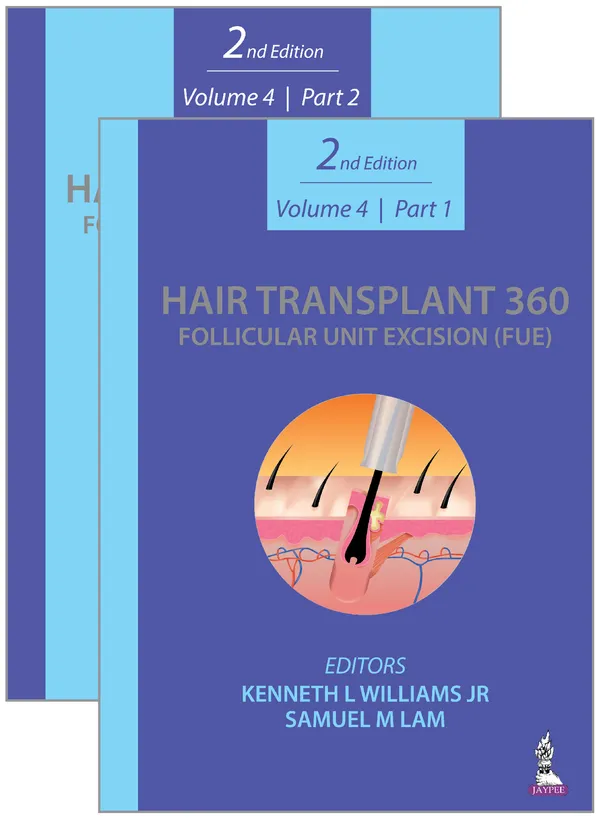 Hair_Transplant_360_Follicular_Unit_Excision_Fue