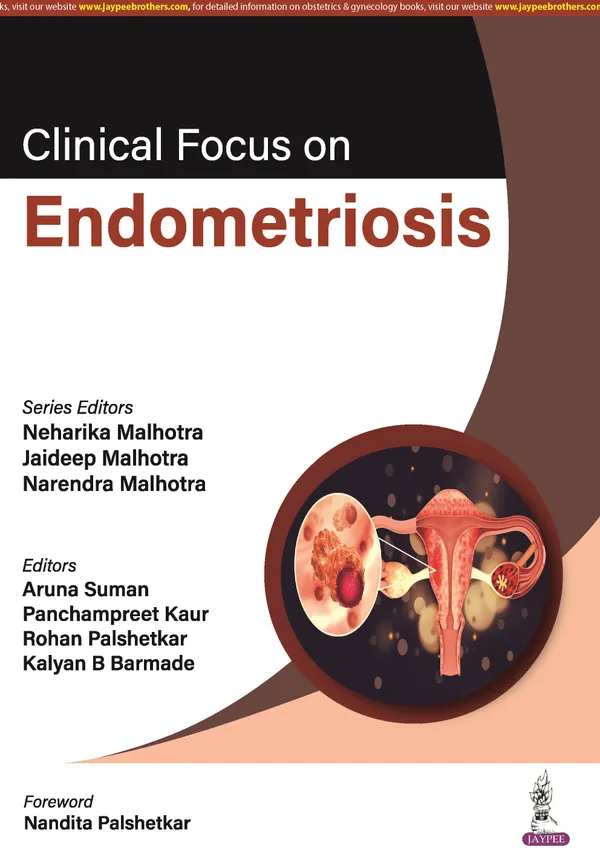 Clinical_Focus_On_Endometriosis