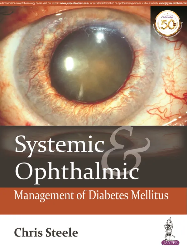 Systemic_Ophthalmic_Management_Of_Diabetes_Mellitus