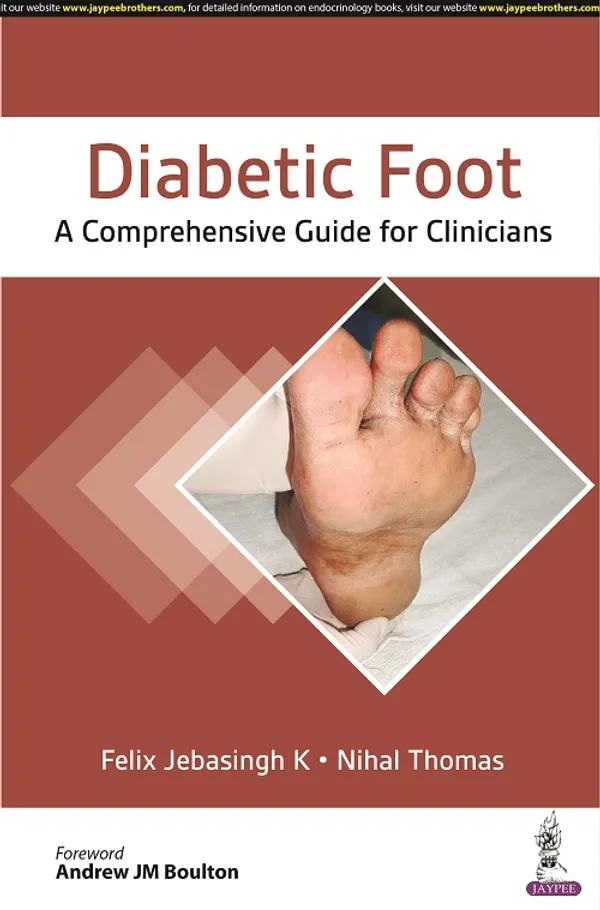 Diabetic_Foot_A_Comprehensive_Guide_For_Clinicians
