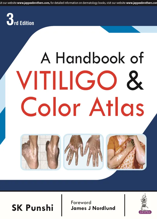 A_Handbook_Of_Vitiligo_Color_Atlas