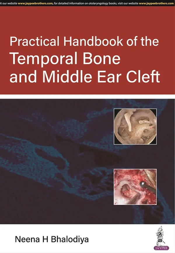 Practical_Handbook_Of_The_Temporal_Bone_And_Middle_Ear_Cleft