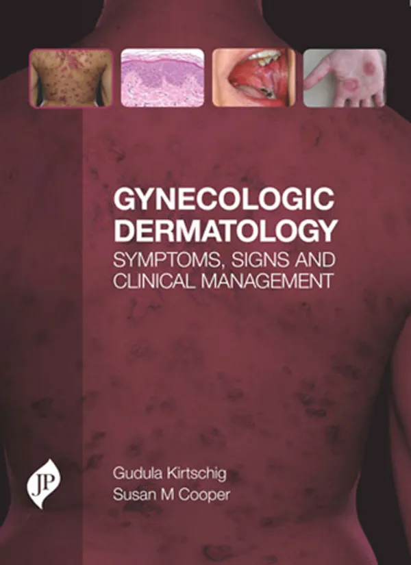 Gynecologic_Dermatology
