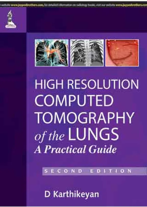 High_Resolution_Computed_Tomography_Of_The_Lungs_A_Practical_Guide