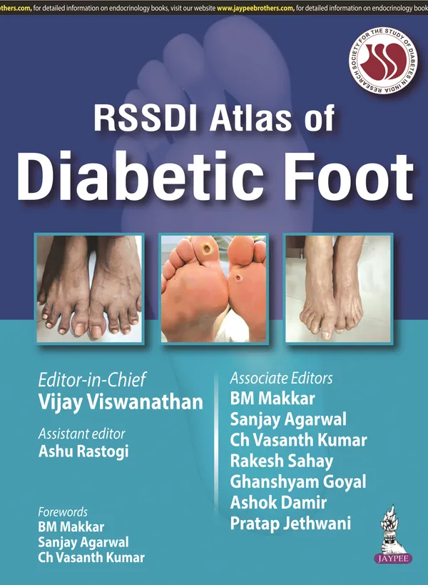 Rssdi_Atlas_Of_Diabetic_Foot