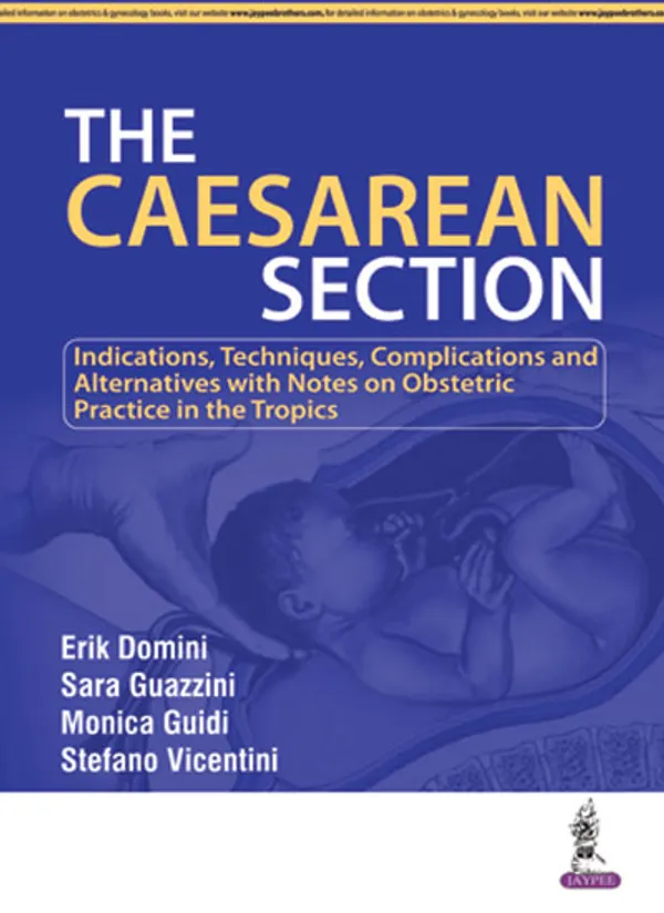 The_Caesarean_Section