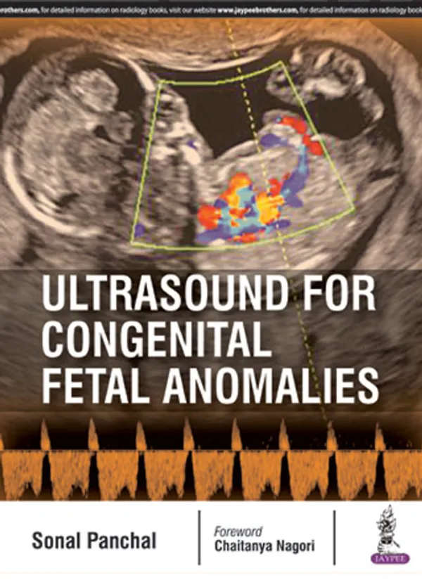 Ultrasound_For_Congenital_Fetal_Anomalies