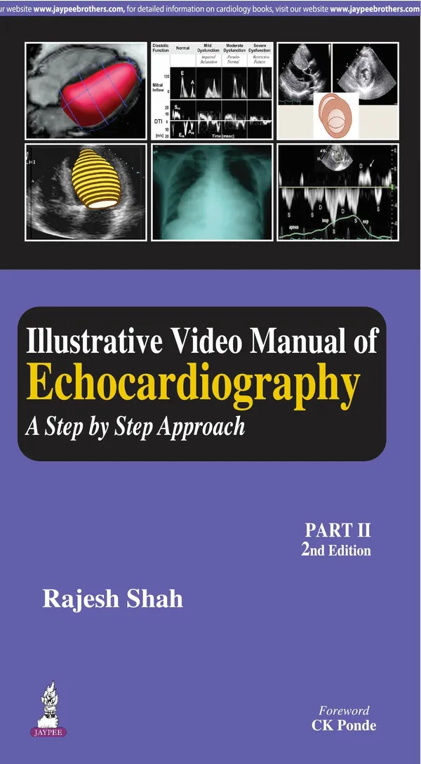 Illustrative_Video_Manual_Of_Echocardiography_A_Step_By_Step_Approach_Part_Ii