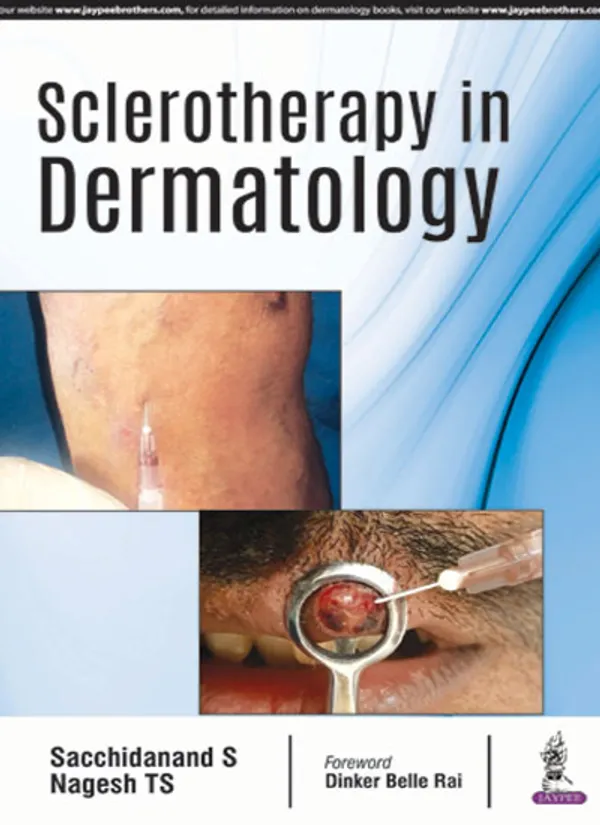 Sclerotherapy_In_Dermatology